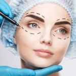 Plastic Surgery